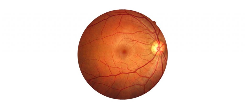 ai-for-heart-disease-prediction-1024×455